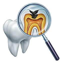 Today s Dental of Boxborough | General Dentistry, Laser Dentistry, Dental Diode Laser and Teeth Whitening