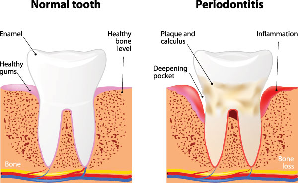 Today s Dental of Boxborough | General Dentistry, Emergency Dentistry and Dental Implants